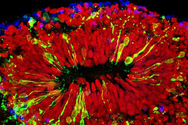 科學家攻克Zika病毒 高中生攜3D打印來幫忙

Zika病毒,3D打印醫療行業,3D打印材料價格,3D打印技術,3D打印材料,3D打印成本,3D打印價格