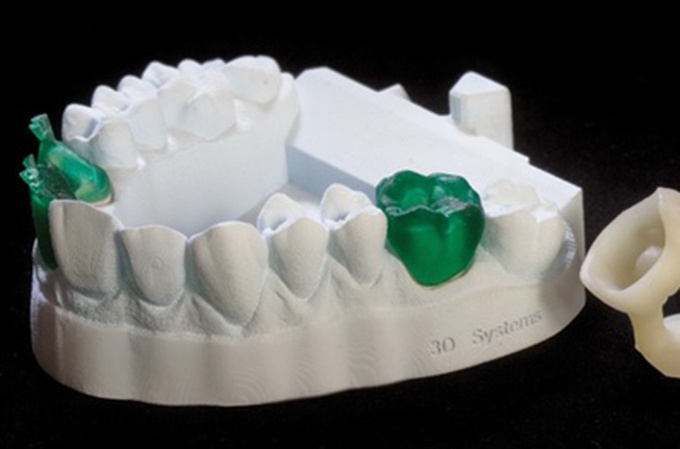 德國率先引入3D打印牙齒技術(shù) 全程體驗“無痛”種牙-e鍵打印|3D打印服務(wù)
3d打印牙齒,3D打印種牙,無痛種牙,3D打印平臺,3D打印服務(wù),南京哪里有3D打印,南京3D打印廠家,南京3D打印服務(wù)
