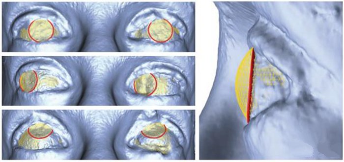 3D打印新技術(shù) 迪斯尼用照片重建繪制3D眼部立體圖_e鍵3D打印服務