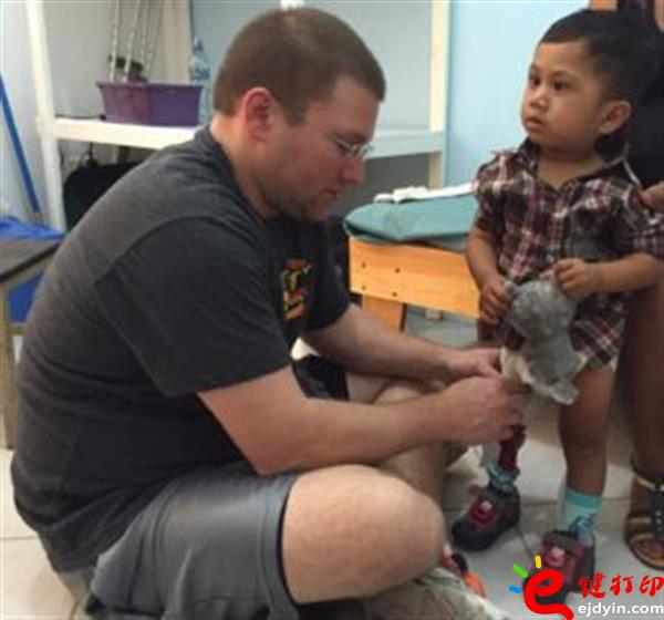 3d打印假肢,3d打印大腿假肢,3d打印假肢好處,3d打印假肢哪里定做,3d打印假肢哪里可以做,3d打印義肢,青島3d打印假肢,3d打印服務