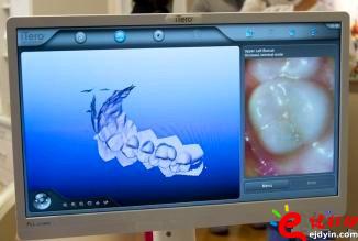 3d打印牙齒價(jià)格,3d打印牙齒模型,3d打印牙齒臨床了嗎,3d打印牙齒價(jià)格表,3d打印牙齒能用多久 3d打印牙齒價(jià)格,3d打印牙齒模型,3d打印牙齒臨床了嗎,3d打印牙齒價(jià)格表,3d打印牙齒能用多久